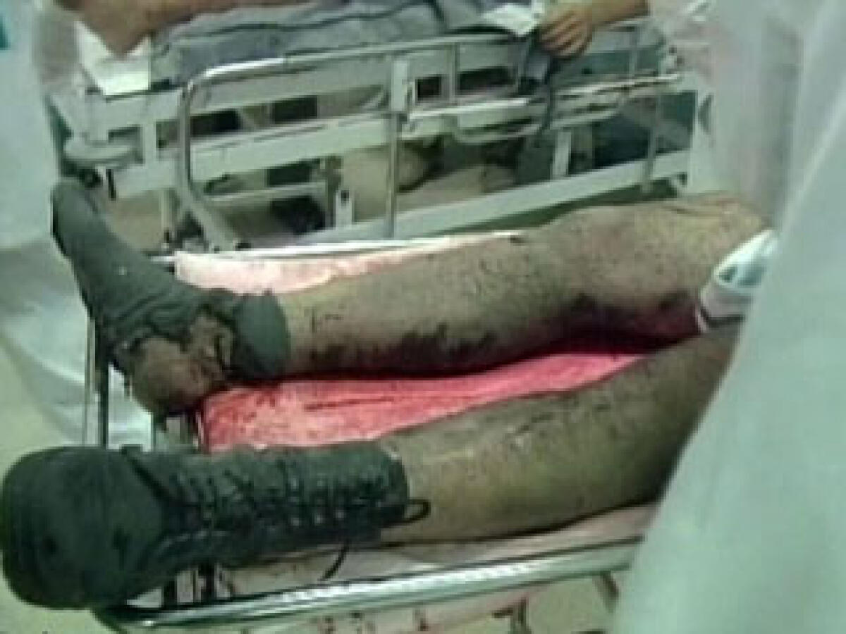Medici all'estero per fare formazione sui cadaveri -