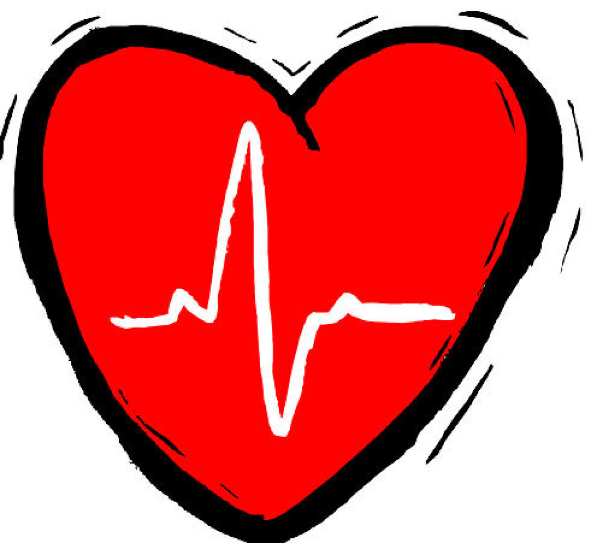 Tre strumenti per monitorare il cuore donati all'ospedale -