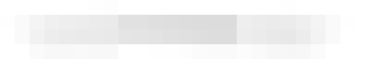 Cade dalla bici per una buca. 20 giorni di prognosi - 