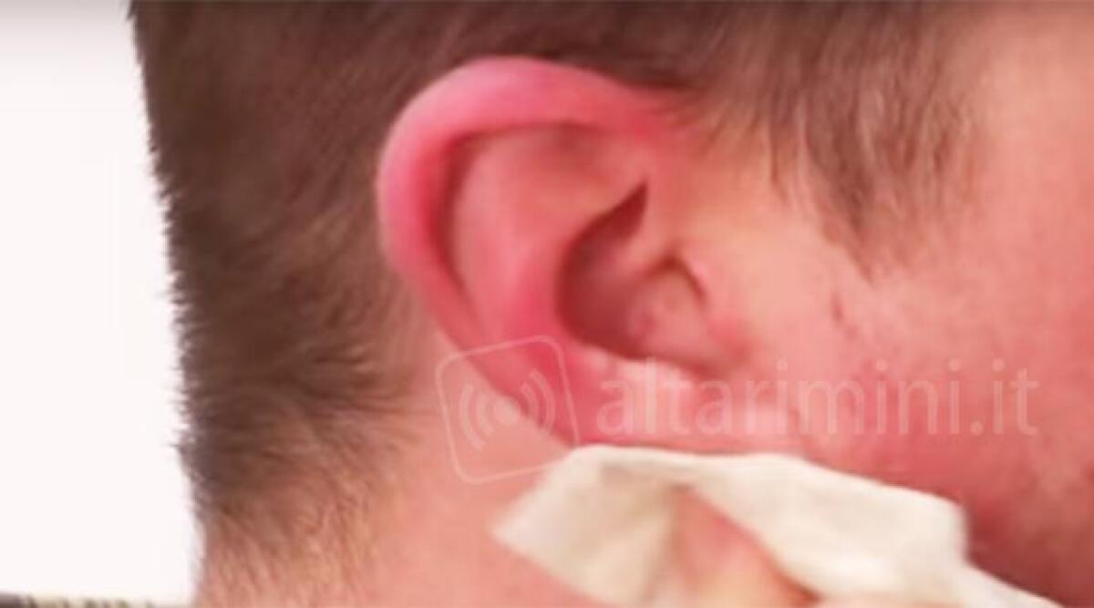 Gli stacca l'orecchio con un morso, vittima chiede un risarcimento da 100mila euro - 