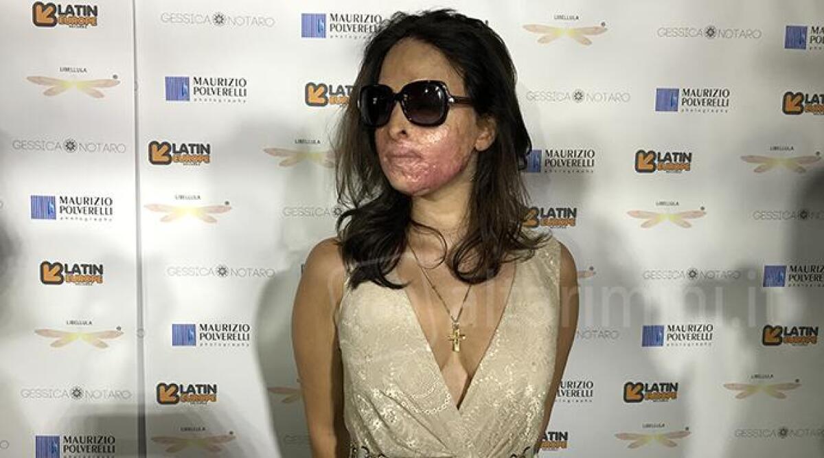 VIDEO: dopo la violenza la vita continua, Gessica Notaro presenta la canzone "Gracias a la vida" -
