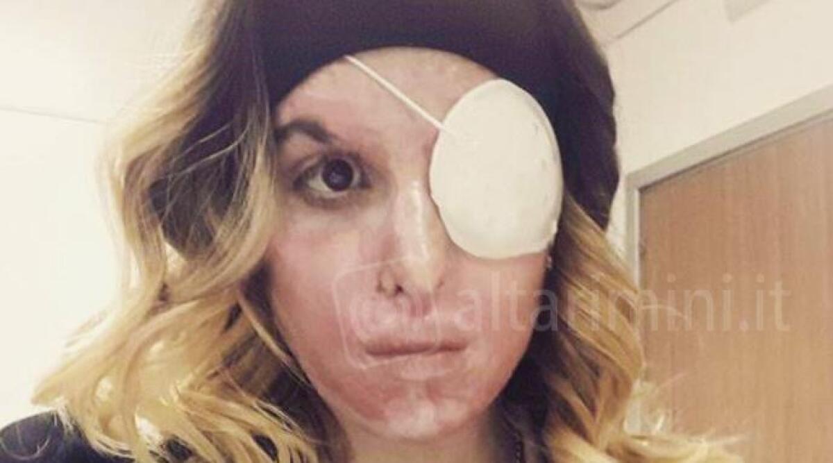 'Ti sciolgo nell'acido come Gessica Notaro', arrestato 42enne per minacce e maltrattamenti alla ex - 