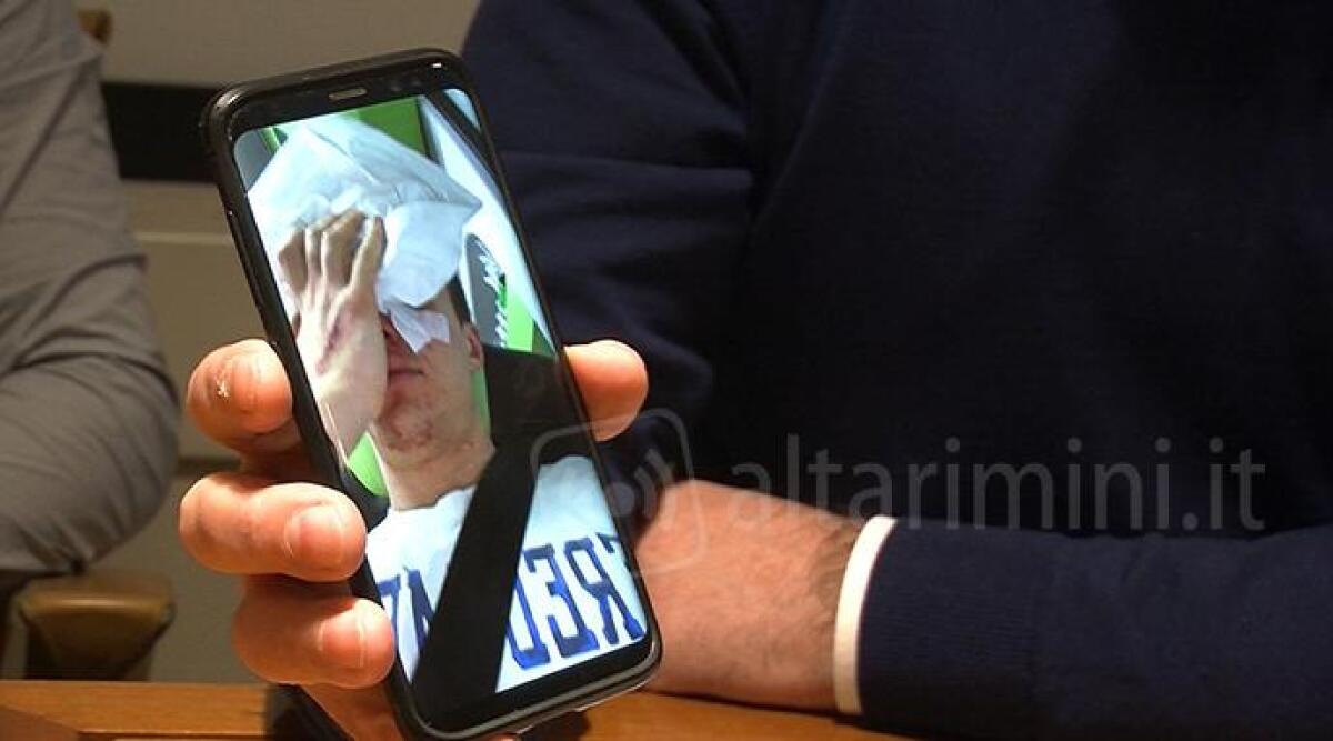 AUDIO Aggredito in discoteca a Cesenatico perch&eacute; omosessuale, il 29enne denuncia con coraggio - 