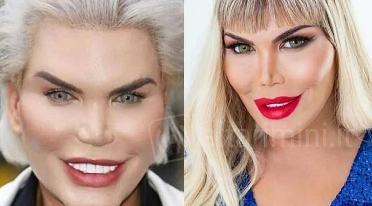 Barbie e Ken umani, "prodotti" della chirurgia o "casi" di psicologia? -