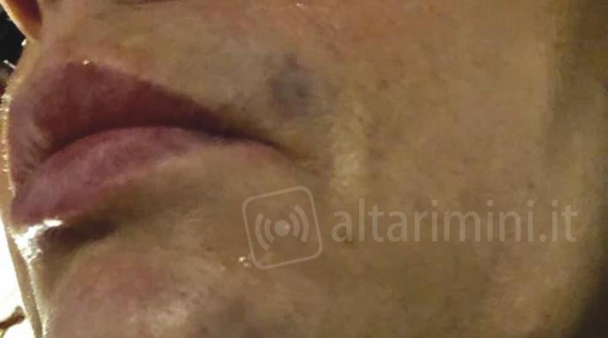 Manifestazione di Mio in piazza Cavour, la moglie di Paesani colpita in faccia da un giovane - 