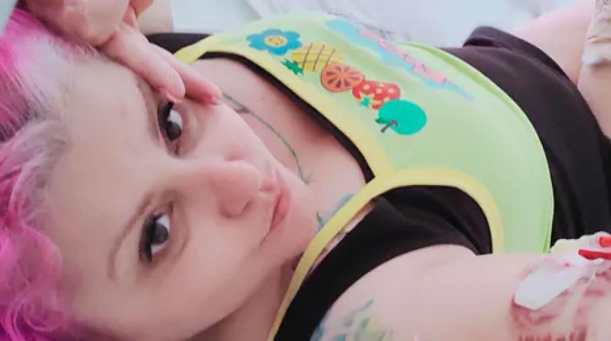Perde gamba dopo incidente, raccolta fondi per una protesi. Rimini in aiuto di Fabiana - Fabiana