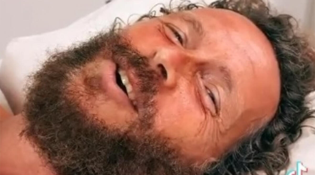 Jovanotti infortunato in bicicletta: intervento chirurgico per tornare in sella - Jovanotti in ospedale dopo un brutto incidente in bicicletta