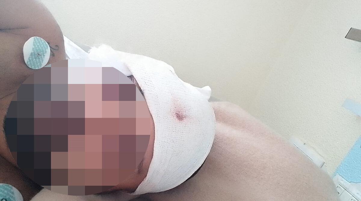 Aggredito con un coccio di bottiglia e rapinato alla stazione di Rimini: la testimonianza della vittima -