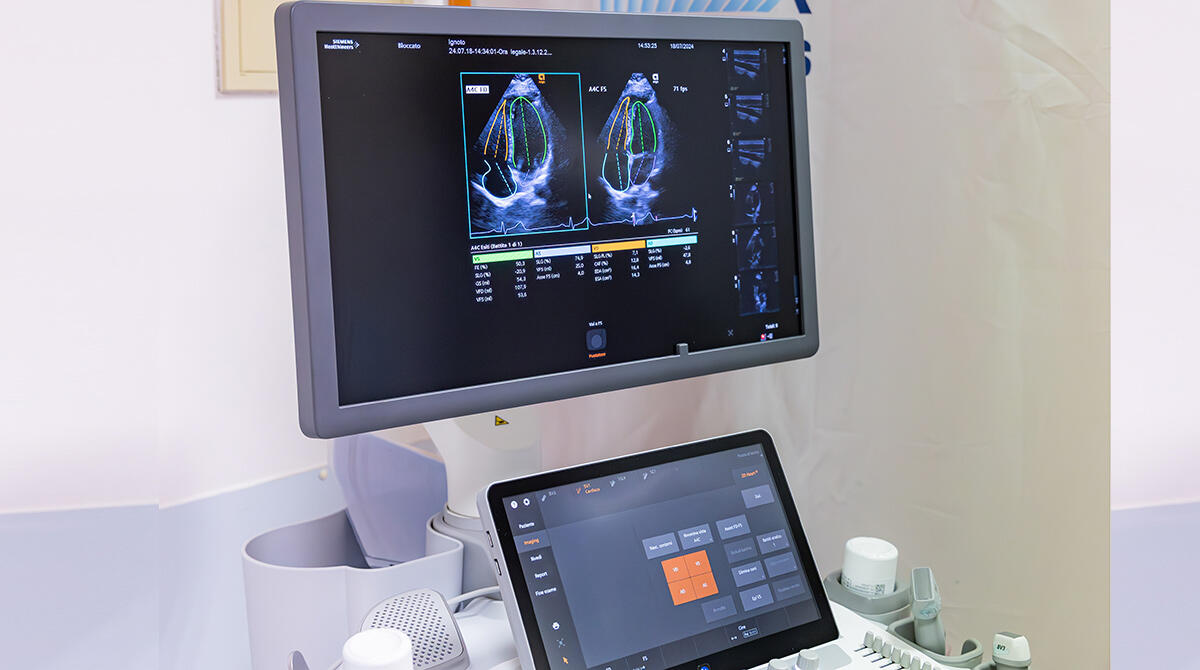 A Rimini verrà sperimentato il nuovo ecografo cardiovascolare dotato di intelligenza artificiale - Nuovo Ecografo con IA al Sol et Salus