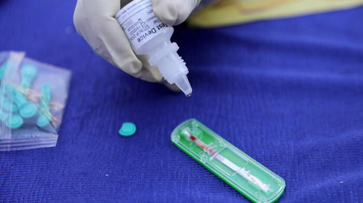 Test dell'HIV gratuiti in provincia di Rimini per la giornata mondiale contro l'Aids - Foto Ansa