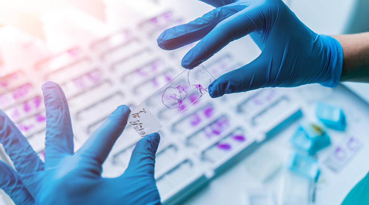 Due tracce di Dna femminile sul corpo di Pierina Paganelli: nuovi dubbi sull’indagine - Test Dna, foto di repertorio