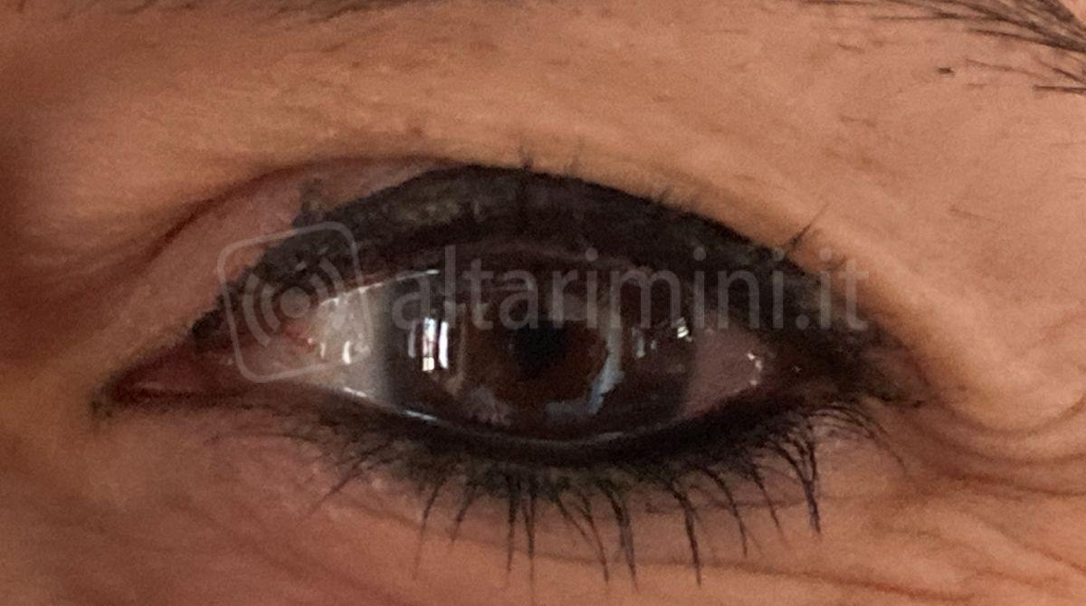 La salute della vista: incontro a Rimini su maculopatia e glaucoma con esperti del settore -