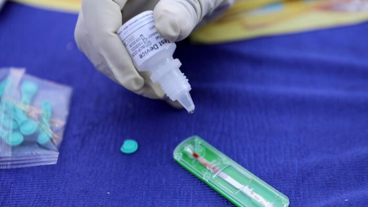 Giornata Mondiale contro l’Aids: dove fare il test Hiv gratuito in provincia di Rimini - 