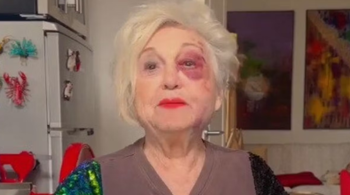 “Sono devastata”: Wanna Marchi travolta da un’auto a Milano - Istagram