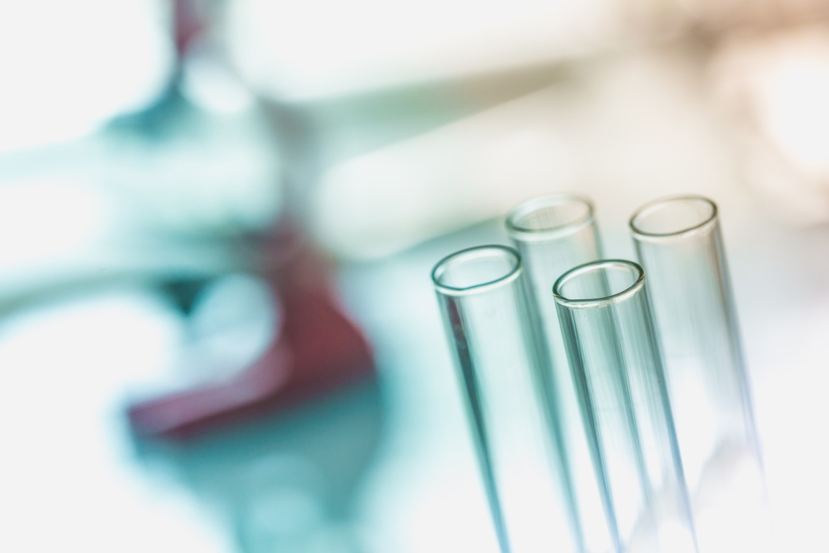 Campobasso, svolta choc: madre e figlia uccise con la ricina - 