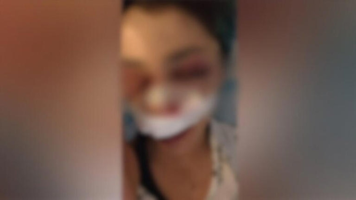 Studentessa aggredita a Bari, identificati i primi due presunti responsabili - 
