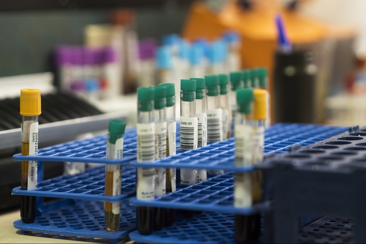 Scambio di embrioni al San Raffaele: ora si punta sul sistema anti-errore - Repertorio