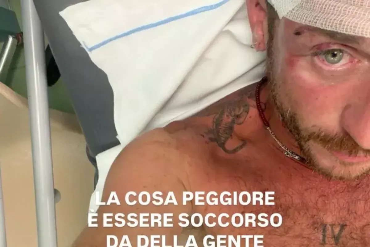 Aggressione omofoba in Sardegna, 39enne denuncia: "In trenta contro uno" - PH ANSA